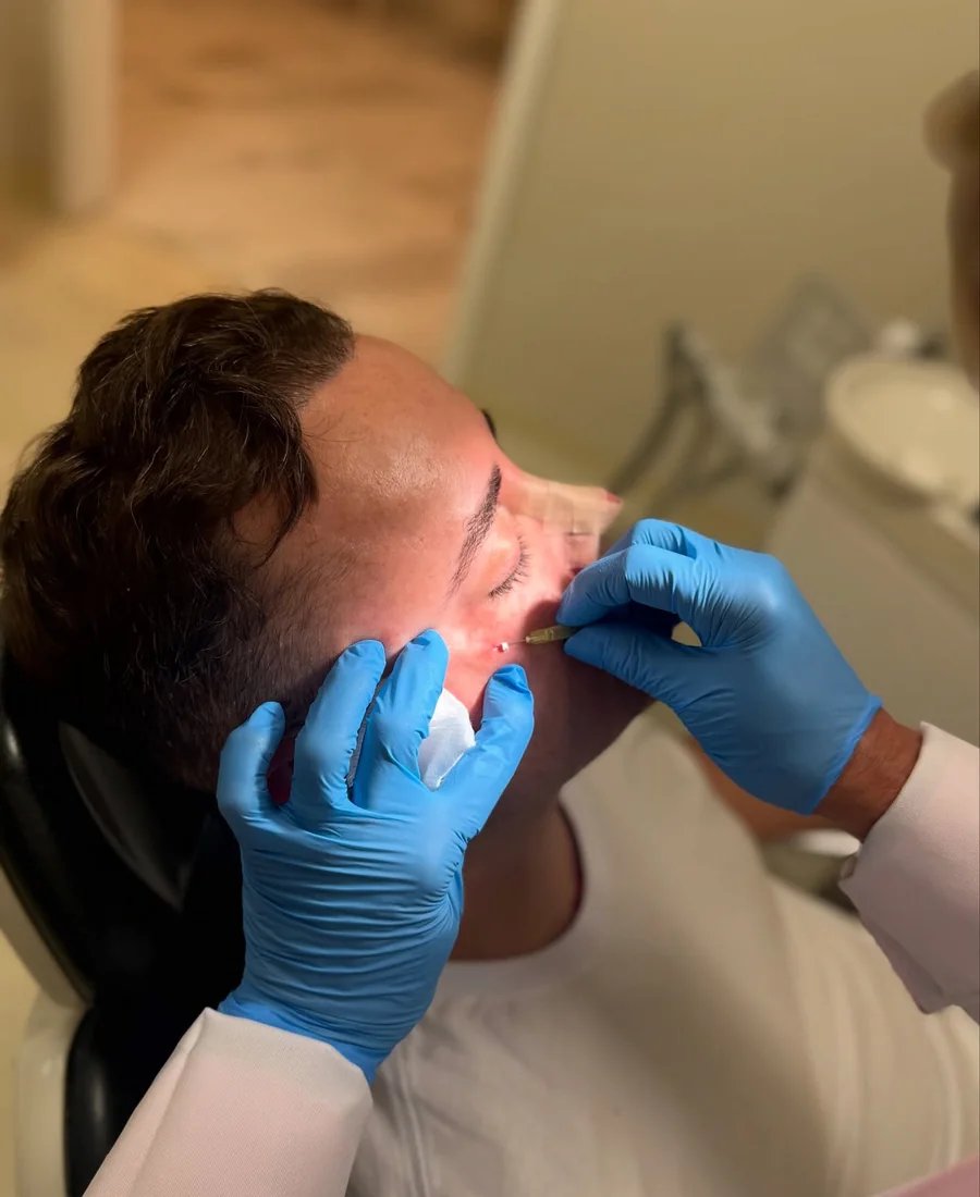 Análise facial 3D Análise 3D